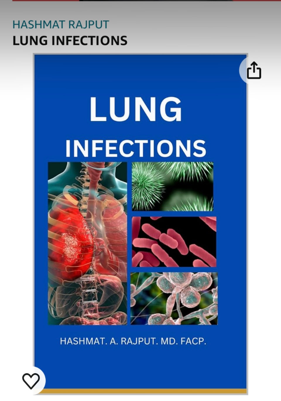 E-BOOK-Lung Infections