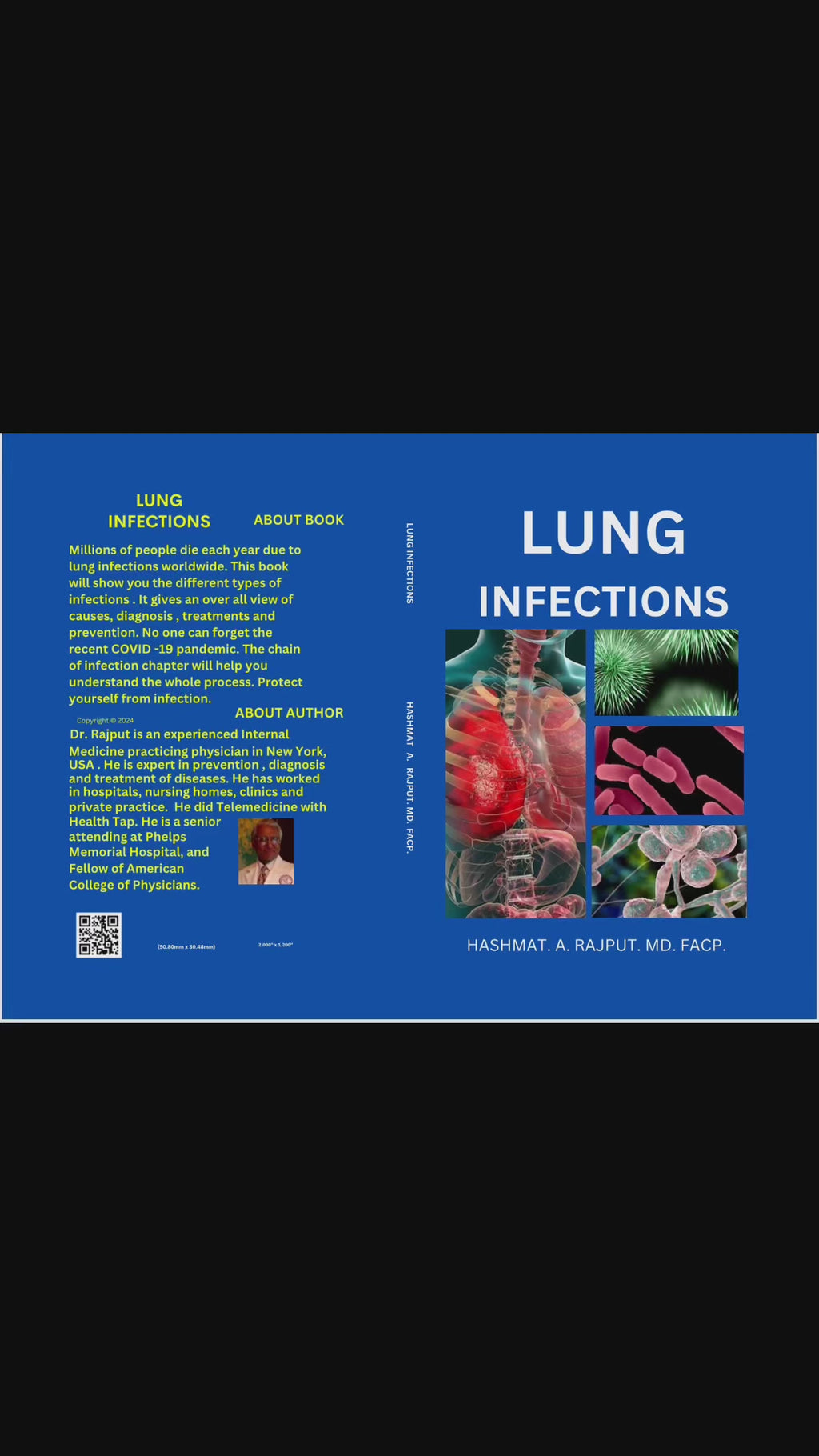 PAPERBACK-Lung Infections
